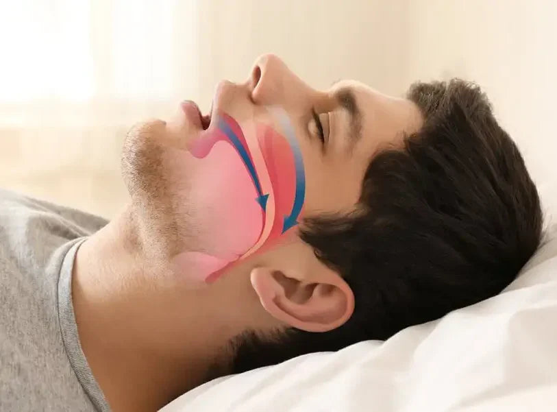 Entendendo o Ronco e Seus Efeitos na Saúde do Sono